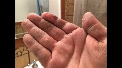 How to Get Spray Foam Off of Hands: A Comprehensive Guide and the Curious Case of Sticky Situations